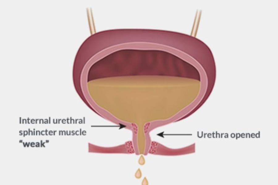 camc-urology-offers-new-treatment-for-urinary-incontinence-camc